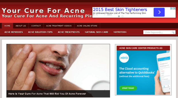 yourcureforacne.com